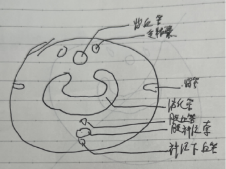 15.png